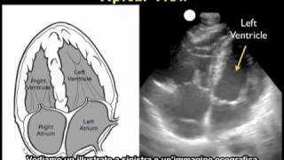 Video procedurale Ecografia cardiaca  Vista apicale [upl. by Coreen]