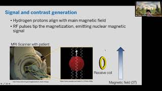 MLX Seminar Prof Tamir  Computational MRI w Deep Learning [upl. by Vanni]