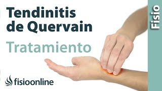 Tendinitis de De Quervain  Tratamiento con ejercicios automasajes y estiramientos [upl. by Silvan]