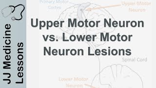 Upper and Lower Motor Neuron Lesions  UMN vs LMN Differences and Mnemonic [upl. by Dal]