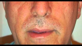 Time Lapse Moustache Growth [upl. by Lekar]