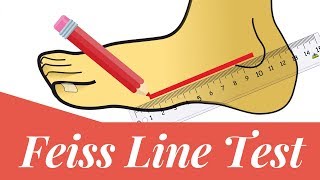 Feiss line test How to measure flat foot [upl. by Ax]