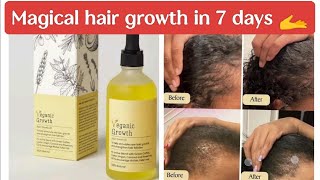 veganic natural hair growth oil review tamil hairfalltreatment [upl. by Elwood649]