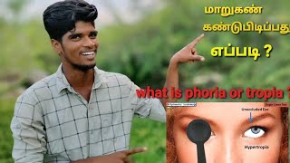 Cover test explain in tamil [upl. by Assina557]