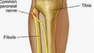 what is common peroneal nerve explained medicalstudent [upl. by Diella]