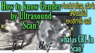 ULTRASOUND SCAN GENDER PREDICTIONCRL ಎಷ್ಟಿದ್ದರೆ ಗಂಡು ಮಗುHow to Know Boy or Girl by NT Scan Report [upl. by Zilevi]