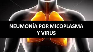 Neumonía por micoplasma y virus [upl. by Hollister]