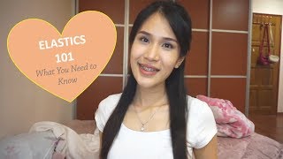 Braces Update 2 years 2 months and Elastics 101 How Do They Work [upl. by Dahsar972]