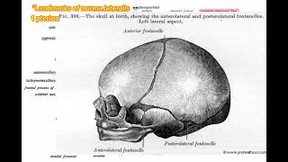 Pterion norma lateralis anatomy skull headandneckanatomy [upl. by Clougher555]