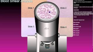 Microscope amp Blood Smear Analysis Lab [upl. by Gamages355]