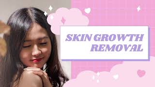 Remove Skin Growths  Subliminal to Get Rid of Unwanted Lumps and Bumps [upl. by Nosyerg]