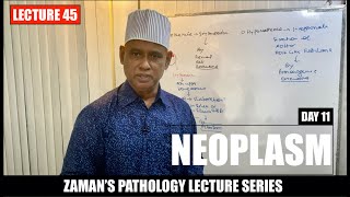 General Pathology Lecture 45  Neoplasm  Day 11 [upl. by Zacks]