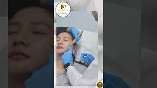 Jaw Botox Procedure [upl. by Weasner]