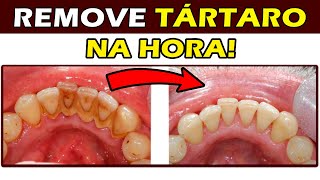 Receita caseira de como deixar os DENTES BRANCOS e prevenir o TÃRTARO dos dentes INFALÃVEL [upl. by Sigsmond864]