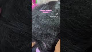 Nits and lice treatment just 2 hrs 💯 results 👍👍👍 [upl. by Lucienne]