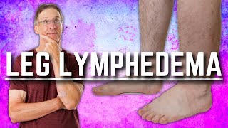 Top 3 Exercises for Leg Lymphedema Swelling or Edema [upl. by Eenalem]