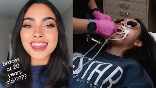 GETTING BRACES ON VLOG PT 1 [upl. by Leary]