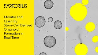 Incucyte Webinar Preview Studying 3D Organoids with LiveCell Analysis [upl. by Cira362]