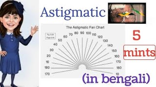 Astigmatic Fan test  Astigmatic dial test  Procedure  OT [upl. by Shellie]