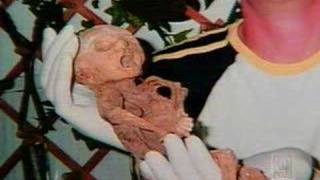 Firm Will Test DNA Of Mummified Baby [upl. by Atekihc]