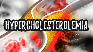 Hypercholesterolemia High Cholesterol  CRASH Medical Review Series [upl. by Hareemas701]