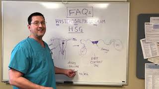 Just the FAQs The HSG Hysterosalpingogram [upl. by Brynna]