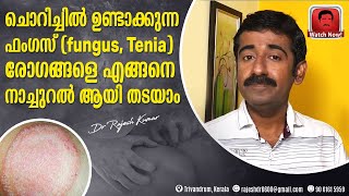 ചൊറിച്ചിൽ ഉണ്ടാക്കുന്ന ഫംഗസ് fungus  Tenia  രോഗങ്ങളെ എങ്ങനെ നാച്ചുറൽ ആയി തടയാം [upl. by Iht]