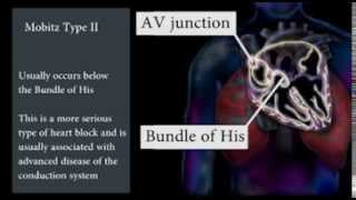 EKG Interpretation and Response SERIES Atrial and Junctional Dysrhythmias and Heart Block [upl. by Akkinahs]