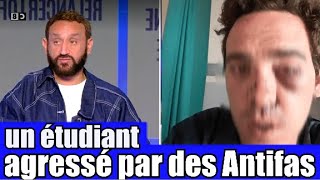 Un étudiant Agressé par des Antifas dans son université 😡 le Tshirt anti J  UIF 🤦‍ TPMP réaction [upl. by Edee]