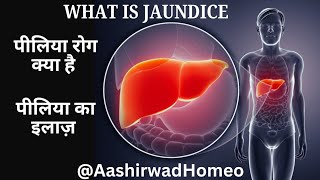 Jaundice  Hemolytic jaundice  Piliya ke lakshan  Why jaundice occurs  Aashirwad Homeo [upl. by Aissilem726]