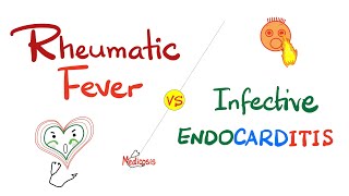 Rheumatic Fever vs Infective Endocarditis  Comparison  Cardiology Series [upl. by Trev414]