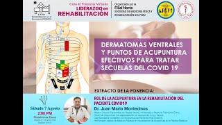 Dermatomas Ventrales y puntos de Acupuntura Efectivos [upl. by Marielle]