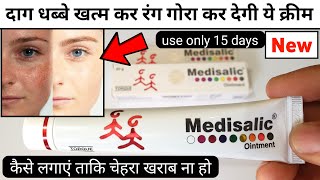 Medisalic Cream Review  how to use medisalic ointment cream [upl. by Sadoc967]