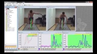 QAngle test with EMG and force vector [upl. by Cristin]