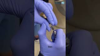 Temporary crown tips with Dr Tami shorts [upl. by Llennoc]