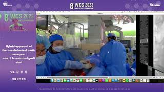 AUDITORIUM 2023 WCS 43  Hybrid approach of thoracoabdominal aortic aneurysm 김장용 [upl. by Wadsworth766]