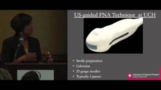 Thyroid Cancer Ultrasound for Nodules Current Guidelines Dr McKinney ThyCa Conference [upl. by Agon917]