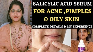 Salicylic Acid Serum 2॥ Really Effective or not ॥ Salicylic acid benefits for acne and pimples ॥ [upl. by Limber531]