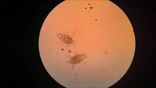 Zooplankton in the Microscope [upl. by Salzhauer]