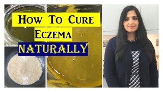 Best Home Remedy For Eczema ⭐ HomeRemediesforEczema  Samyuktha Diaries [upl. by Ak]