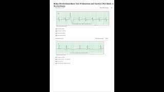 Relias Dysrhythmia Basic Test 35 Questions and Answers 2023 Basic A Dysrhythmia [upl. by Ylehsa]