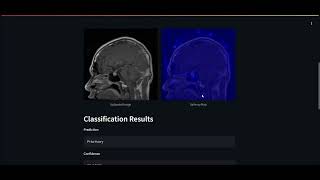 Brain Tumor Classification with Neural Networks  Barnabas Novak [upl. by Ellehcem]