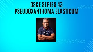 OSCE Series Episode 43  Pseudoxanthoma Elasticum [upl. by Enrobialc]