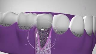 Nuestros tratamientos Dentix Curetaje Higiene dental Agenda tu cita 552 [upl. by Avik]