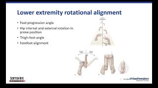 Lower Extremity Alignment [upl. by Yatnuhs]