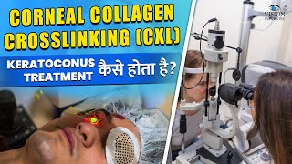 Corneal Collagen Crosslinking CXL Treatment कैसे होता है  Keratoconus Treatment Procedure [upl. by Fonda581]