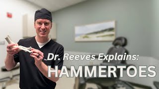 Hammertoes Causes Symptoms Treatments [upl. by Nylorahs]