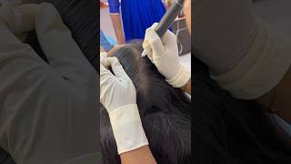 Scalp Micropigmentation Treatment  SH Beauty Clinic amp Institute proddatur helloproddatur [upl. by Tierell938]