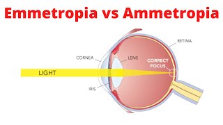 Emmetropia vs Ammetropia [upl. by Peckham146]