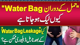 Water Bag Leakage Pani Ki Theli Ka Phat Jana  What To Do If Water Bag Gets Leaked During Pregnancy [upl. by Ainer140]